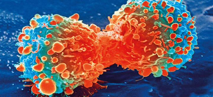 Un nuevo sistema mejora la caracterización de tumores sólidos e informa sobre su evolución