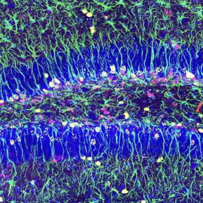 Descubren el mecanismo que asegura la reserva de células madre para la generación neuronal en la edad adulta