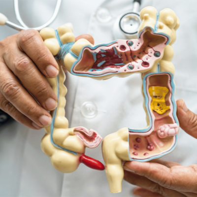 Un estudio muestra una nueva perspectiva sobre los mecanismos de progresión en la enfermedad de Crohn